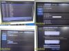 PHILIPS iU22 Diag Ultrasound W/ L17-5, L15-7io, C8-5 Probes &Foot Control