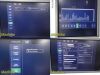 PHILIPS iU22 Diag Ultrasound W/ L17-5, L15-7io, C8-5 Probes &Foot Control