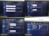 PHILIPS iU22 Diag Ultrasound W/ L17-5, L15-7io, C8-5 Probes &Foot Control