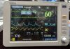MINDRAY uMEC6 Monitor