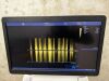 GE Vivid E90 Ultrasound - Cardiac - Vascular