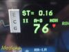 SPACELABS 91370 Ultraview SL Patient Monitor
