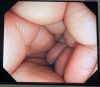 OLYMPUS GIF-HQ290 Gastroscope