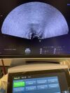 GE HEALTHCARE IC5-9-D Ultrasound Transducer