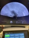 GE HEALTHCARE IC5-9-D Ultrasound Transducer