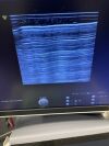 GE HEALTHCARE 9L-D Ultrasound Transducer