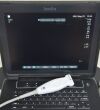FUJIFILM SonoSite Edge II Ultrasound System w/ L25x/13-6MHz Transducers DOM2018 - 192789 SonoSite Edge II