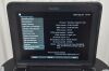 FUJIFILM SonoSite Edge II Ultrasound System w/ L25x/13-6MHz Transducers DOM2018 - 192789 SonoSite Edge II