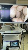 OLYMPUS CV-1500 Endoscopy Processor