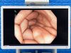 OLYMPUS CV-190/CLV-190 Tower Endoscope