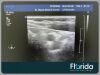 PHILIPS L9-3 LINEAR ARRAY TRANSDUCER PROBE REF 453561177105 FOR IU22/IE33 TESTED 30 DAYS WARRANTY Ultrasound Transducer