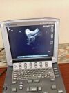 SONOSITE ICT/8-5 Ultrasound Transducer