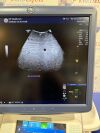 GE HEALTHCARE GE C1-6  Ultrasound Transducer Ultrasound Transducer