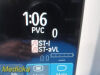 PHILIPS Intellivue MP30 , M8002A W/ MMS Module & NEW Leads ~Patient Monitor