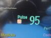 PHILIPS 2005  Intellivue MP20, Ref M8001A W/ MMS Module & NEW Leads ~ Monitor