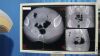 MEDTRONIC Medtronics O-Arm O-Arm