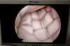 OLYMPUS A5307 0° Hysteroscope