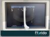 PHILIPS C10-3V IPX-7 CURVED ARRAY TRANSDUCER PROBE REF 453561386025 TESTED 30 DAYS WARRANTY Ultrasound Transducer