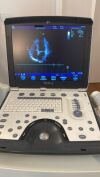 GE Vivid Q Ultrasound - Shared Service