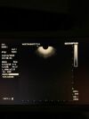 OLYMPUS GF-UCT180 Gastroscope