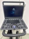 SONOSCAPE E2 Ultrasound - OB / GYN - Vascular