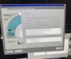 SIEMENS Espree 1.5T MRI Scanner