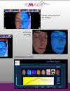 EMAGE NEW IMAGE PRO LE Skin Imaging System