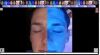 EMAGE NEW Image PRO Opera 3D Digital Skin Imaging