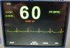 IVY BIOMEDICAL 3000 CARDIAC TRIGGER MONITOR