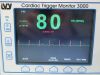 IVY BIOMEDICAL 3000 CARDIAC TRIGGER MONITOR