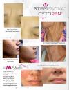 EMAGE PRO StemFacial Advanced Cytokine Duo (2 of  14.0ml chambers per unit)