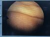 OLYMPUS BF-P60 Bronchoscope