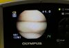 OLYMPUS MAF-GM Intubation Scope