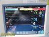 PHILIPS 2010  Intellivue MP20 ,Ref M8002A W/ MMS Module & Leads ~ Monitor