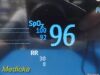 PHILIPS 2010  Intellivue MP20 ,Ref M8002A W/ MMS Module & Leads ~ Monitor