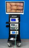 STRYKER 1588 AIM System Laparoscope