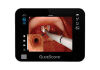 VERATHON 0570-0376 Glidscope CORE 10 Integrated Monitor