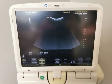 HITACHI Noblus Portable Ultrasound