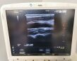 HITACHI Noblus Portable Ultrasound