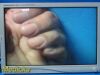 STRYKER 26" Vision Elect HDTV Surgical,Ref 240-030-960 W/ Adapter ~ Monitor