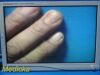 STRYKER 26" Vision Elect HDTV Surgical,Ref 240-030-960 W/ Adapter ~ Monitor
