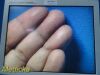 STRYKER ENDOSCOPY Stryker 21" Vision Elect Flat Panel,Ref 240-030-930 W/ PSU ~ Monitor