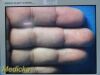STRYKER ENDOSCOPY Stryker 21" Vision Elect Flat Panel,Ref 240-030-930 W/ PSU ~ Monitor
