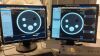 PHILIPS iCT 256 CT Scanner