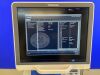 TOSHIBA Aplio 400 Ultrasound System