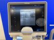 TOSHIBA Aplio 400 Ultrasound System