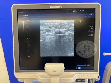 TOSHIBA Aplio 400 Ultrasound System