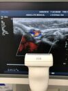 PHILIPS L12-5 Ultrasound Transducer