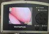 OLYMPUS MAF-GM Intubation Scope
