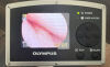 OLYMPUS MAF-GM Intubation Scope